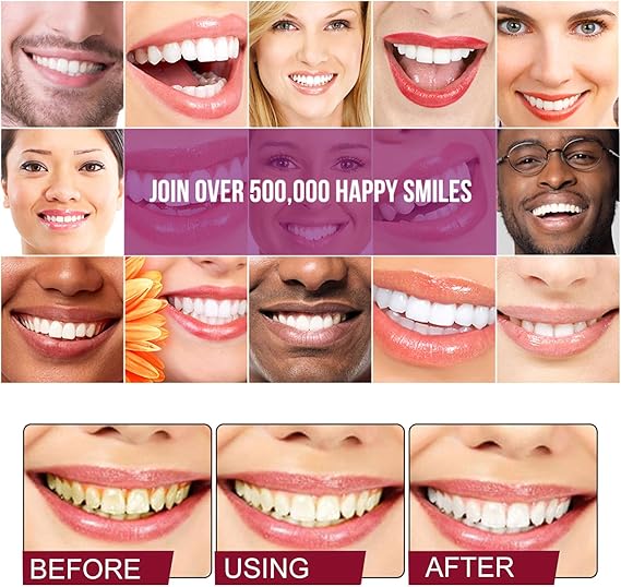 SP-4 ultra Whitening Probiotic Paste